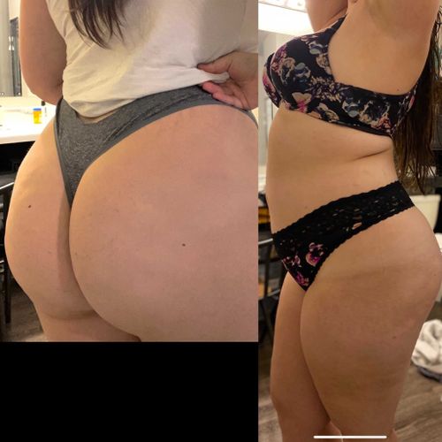 @asslynnn nude asslynnn nude