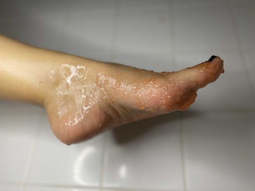 @tootzie.toez nude tootzie.toez nude