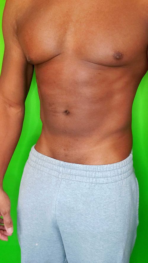 @musclephantom