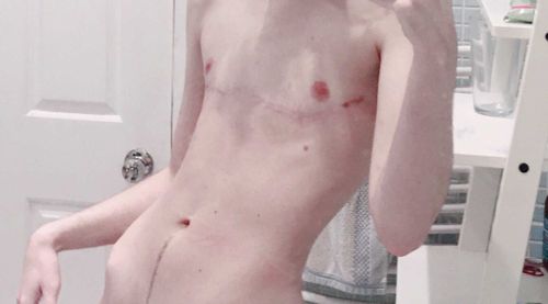 strawberryteeth nude