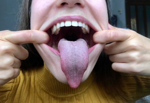 @vore_elx